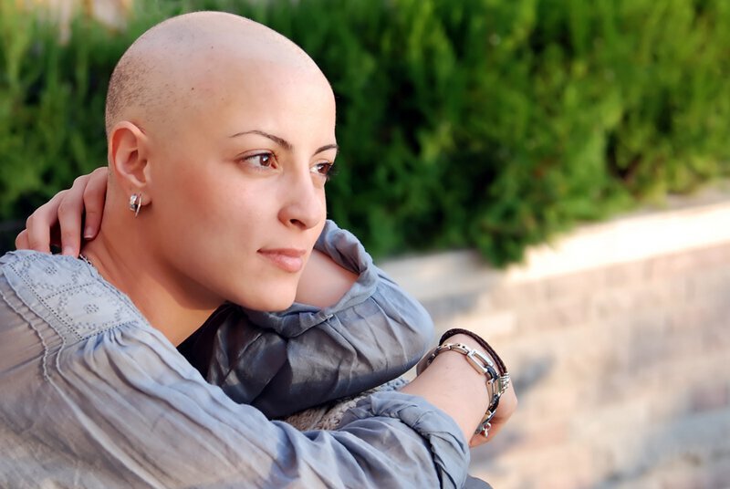 Cancer-related hair loss is not uncommon, and patients should feel informed about their condition and how to cope.
