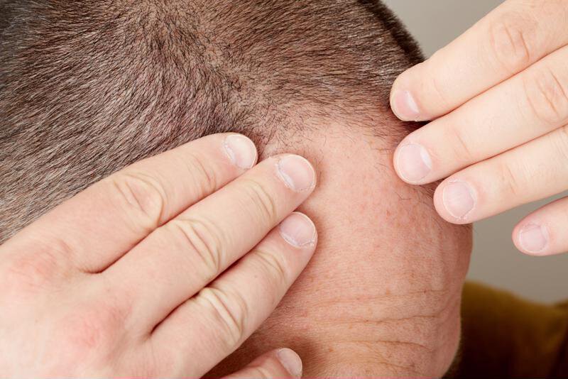 Scalp stimulation can improve hair health but not hair growth.